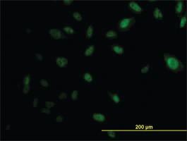 Anti-EP300 Mouse Monoclonal Antibody [clone: 1D2]