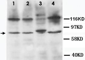 Anti-TNFRSF1B Rabbit Polyclonal Antibody