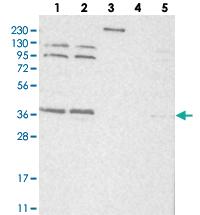 Anti-SLC10A4 Rabbit Polyclonal Antibody