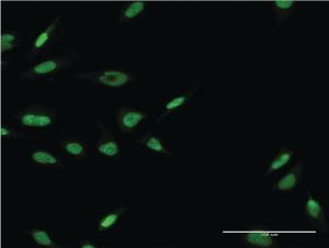 Anti-LHX6 Mouse Monoclonal Antibody [clone: 1B11]