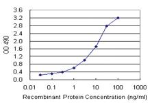 Anti-MS4A1 Polyclonal Antibody Pair