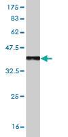 Anti-TLR7 Mouse Monoclonal Antibody [clone: 2C9]