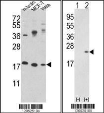 Anti-CFL1 Rabbit Polyclonal Antibody (PE (Phycoerythrin))