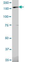 Anti-EIF5B Mouse Polyclonal Antibody