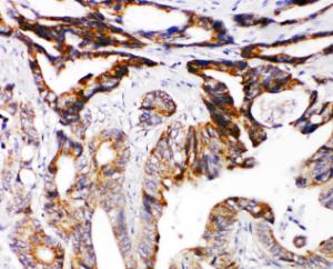 Anti-DCC Rabbit Polyclonal Antibody