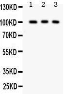 Anti-CD146 Polyclonal Antibody