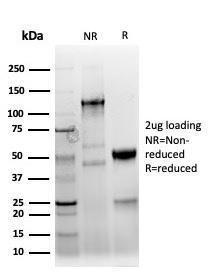 Anti-Keratin 77 antibody