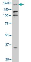 Anti-EP300 Mouse Monoclonal Antibody [clone: 1D2]