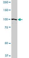 Anti-PDCD6IP Rabbit Polyclonal Antibody