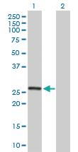 Anti-MRPL10 Mouse Polyclonal Antibody