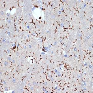 Immunohistochemistry analysis of paraffin-embedded rat brain using Anti-Iba1 Antibody [ARC2301] (A307823) at a dilution of 1:100 (40x lens). Perform microwave antigen retrieval with 10 mM Tris/EDTA buffer pH 9.0 before commencing with IHC staining protocol.