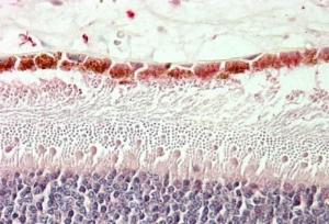 Anti-RDH5 Antibody (A84825) (5 µg/ml) staining of paraffin embedded Human Retina. Steamed antigen retrieval with citrate buffer pH 6, AP-staining