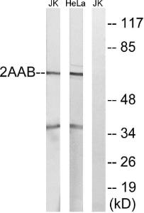 Western blot analysis of lysates from HeLa and Jurkat cells using Anti-PPP2R1B Antibody. The right hand lane represents a negative control, where the antibody is blocked by the immunising peptide