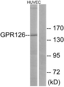 Anti-GPCR GPR126 Rabbit Polyclonal Antibody