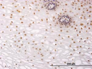 Anti-NR2C2 Mouse Monoclonal Antibody [clone: 2A5]