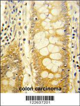 Anti-Galectin-2 Rabbit Polyclonal Antibody (FITC (Fluorescein))