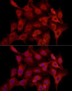 Antibody A92920-100 100 µl