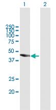 Anti-TBC1D16 Mouse Polyclonal Antibody