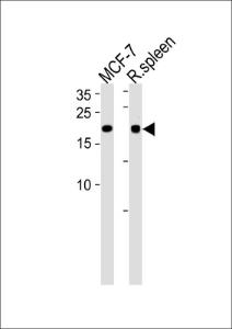 Anti-CNBP Rabbit Polyclonal Antibody (AP (Alkaline Phosphatase))