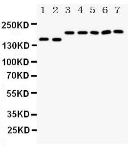 Anti-DCC Rabbit Polyclonal Antibody