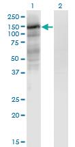 Anti-EPAS1 Mouse Monoclonal Antibody [clone: 1G2]