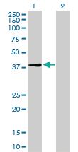 Anti-AURKB Mouse Monoclonal Antibody [clone: 6G8]