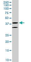 Anti-LHX6 Mouse Monoclonal Antibody [clone: 3E8]