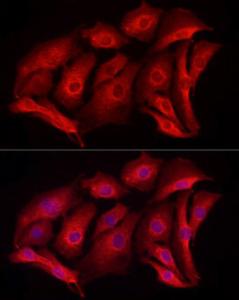 Antibody A92920-100 100 µl