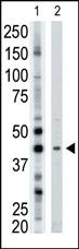 Anti-ATG3 Rabbit Polyclonal Antibody