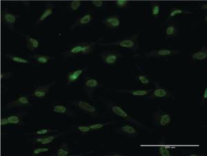 Anti-EPAS1 Mouse Monoclonal Antibody [clone: 1G2]