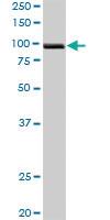 Anti-PDCD6IP Rabbit Polyclonal Antibody