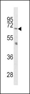 Anti-Proprotein Convertase 2 Rabbit Polyclonal Antibody