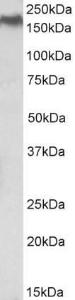 Anti-NPC1 Antibody (A84827) (05 µg/ml) staining of HEK293 lysate (35 µg protein in RIPA buffer) Primary incubation was 1 hour Detected by chemiluminescence