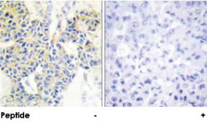 Anti-RPS6KB1 Rabbit Polyclonal Antibody