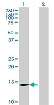 Anti-CLDND2 Mouse Polyclonal Antibody