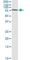 Anti-GTF2A1L Antibody Pair