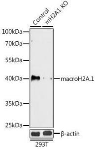 Western blot analysis of extracts from normal (control) and macroH2A