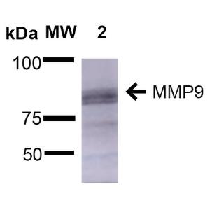 Western blot analysis of rat brain showing detection of ~92 kDa and ~82 kDa (pro and active) MMP9 protein using Anti-MMP9 Antibody [S51-82] (A305026) at 1:1,000 for 2 hours at room temperature Lane 1: Molecular Weight Ladder (MW) Lane 2: rat Brain Load: 15  µg Block: 5% Skim Milk in 1X TBST