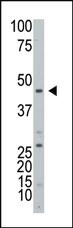 Anti-KDM3B Rabbit Polyclonal Antibody