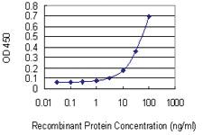 Anti-EPAS1 Mouse Monoclonal Antibody [clone: 1G2]