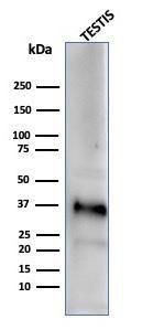 Anti-Clusterin Mouse Monoclonal Antibody [clone: CLU/4729]