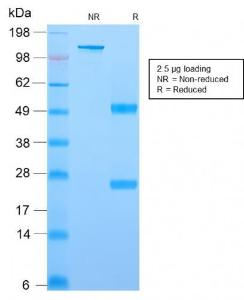 SDS-PAGE analysis of Anti-YB1 Antibody [rYBX1/2430] under non-reduced and reduced conditions; showing intact IgG and intact heavy and light chains, respectively. SDS-PAGE analysis confirms the integrity and purity of the Antibody