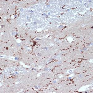 Immunohistochemistry analysis of paraffin-embedded human brain tissue using Anti-Iba1 Antibody [ARC2301] (A307823) at a dilution of 1:100 (40x lens). Perform microwave antigen retrieval with 10 mM Tris/EDTA buffer pH 9.0 before commencing with IHC staining protocol.