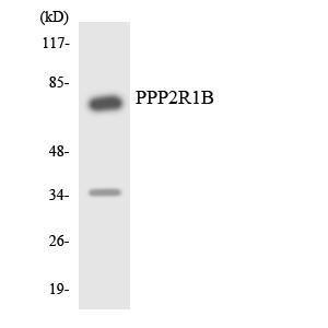 Western blot analysis of the lysates from Jurkat cells using Anti-PPP2R1B Antibody