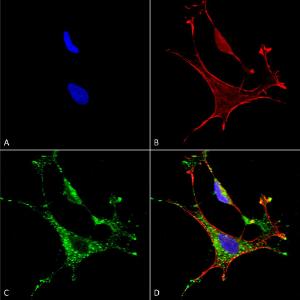 Immunocytochemistry/Immunofluorescence analysis of human neuroblastoma cells (SH-SY5Y), fixed in 4% PFA for 15 min, using Anti-MMP9 Antibody [S51-82] (A305026), at 1:50 for overnight at 4°C with slow rocking