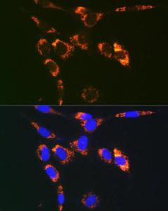 Anti-SYBL1 / VAMP-7 Rabbit Polyclonal Antibody