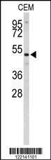 Anti-CNDP1 Rabbit Polyclonal Antibody (AP (Alkaline Phosphatase))