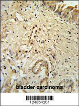 Anti-ID4 Rabbit Polyclonal Antibody (FITC (Fluorescein Isothiocyanate))