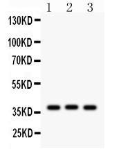 Anti-CTGF Rabbit Polyclonal Antibody