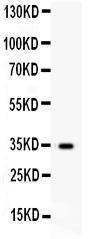 Anti-HGF Polyclonal Antibody